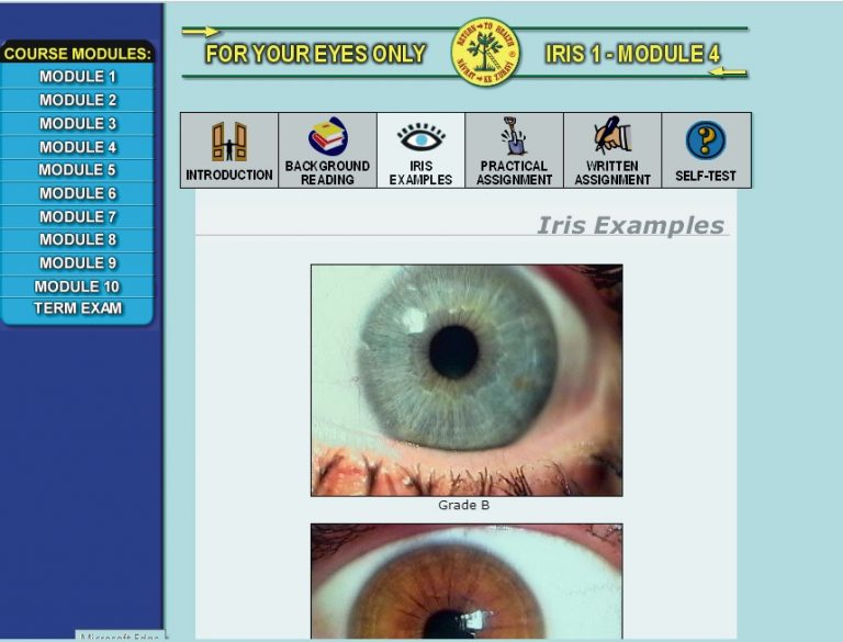 IRIDOLOGY > COURSES Accredited Iridology courses, iridology cameras